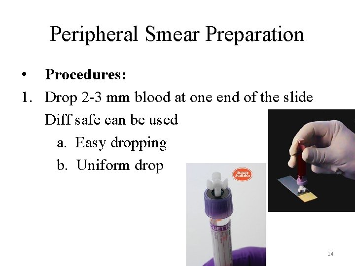 Peripheral Smear Preparation • Procedures: 1. Drop 2 -3 mm blood at one end