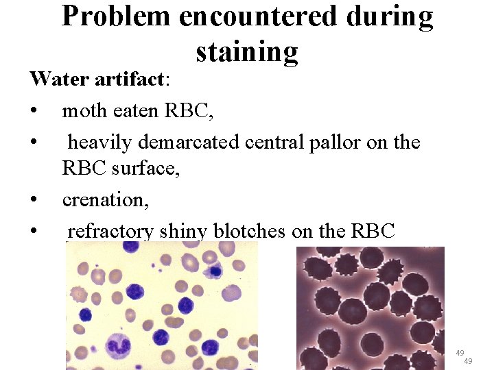 Problem encountered during staining Water artifact: • moth eaten RBC, • heavily demarcated central
