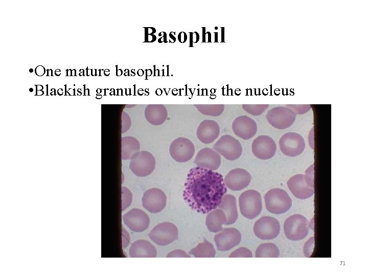 Basophil • One mature basophil. • Blackish granules overlying the nucleus 71 