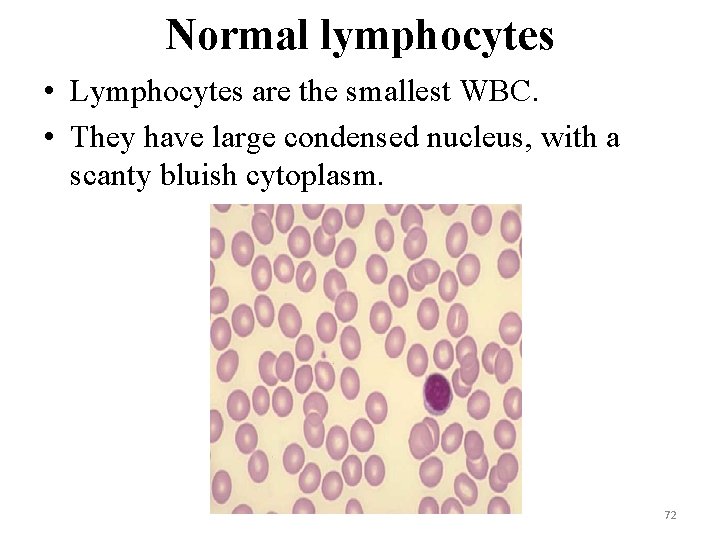 Normal lymphocytes • Lymphocytes are the smallest WBC. • They have large condensed nucleus,