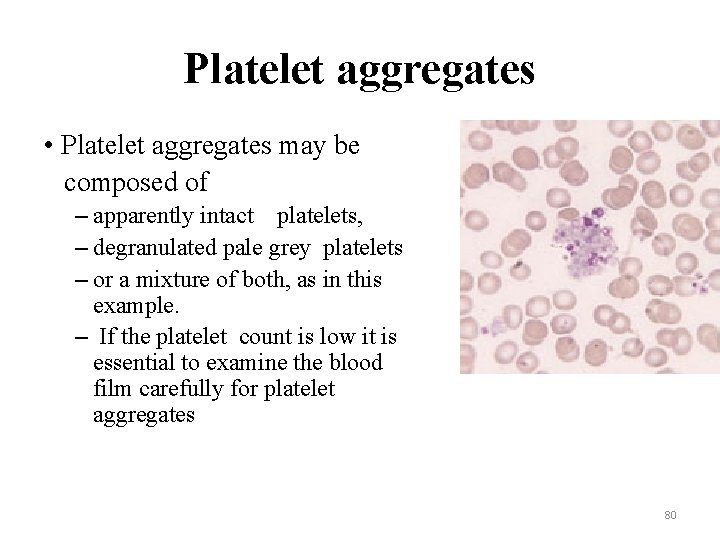 Platelet aggregates • Platelet aggregates may be composed of – apparently intact platelets, –
