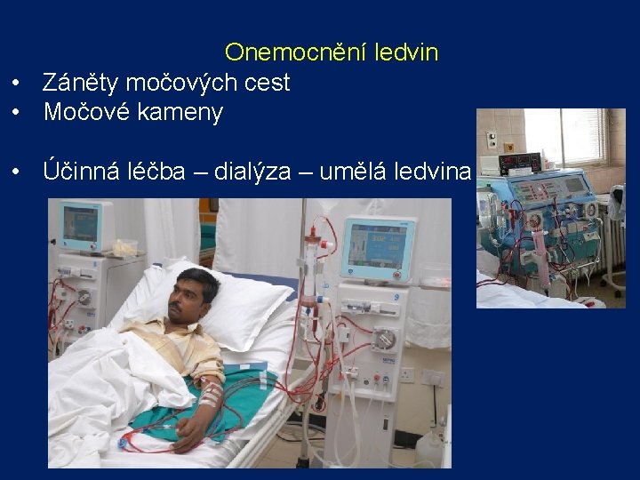 Onemocnění ledvin • Záněty močových cest • Močové kameny • Účinná léčba – dialýza Onemocnění ledvin • Záněty močových cest • Močové kameny • Účinná léčba – dialýza