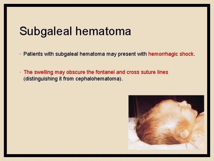 Subgaleal hematoma • Patients with subgaleal hematoma may present with hemorrhagic shock. • The