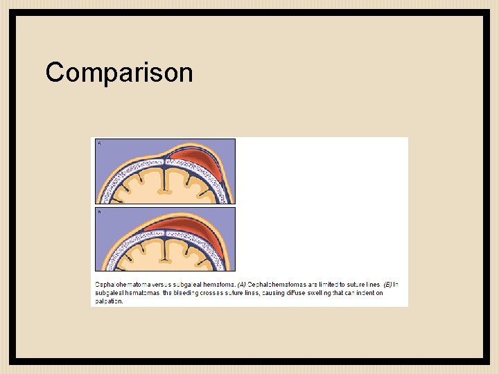 Comparison 