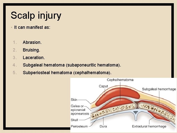 Scalp injury • It can manifest as: 1. Abrasion. 2. Bruising. 3. Laceration. 4.