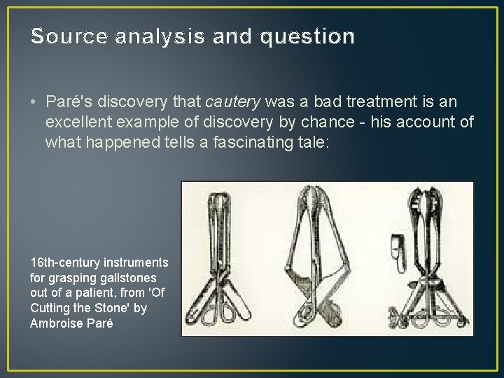 Source analysis and question • Paré's discovery that cautery was a bad treatment is
