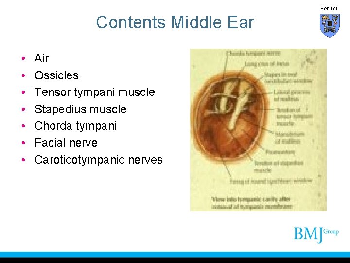 MOB TCD Contents Middle Ear • • Air Ossicles Tensor tympani muscle Stapedius muscle