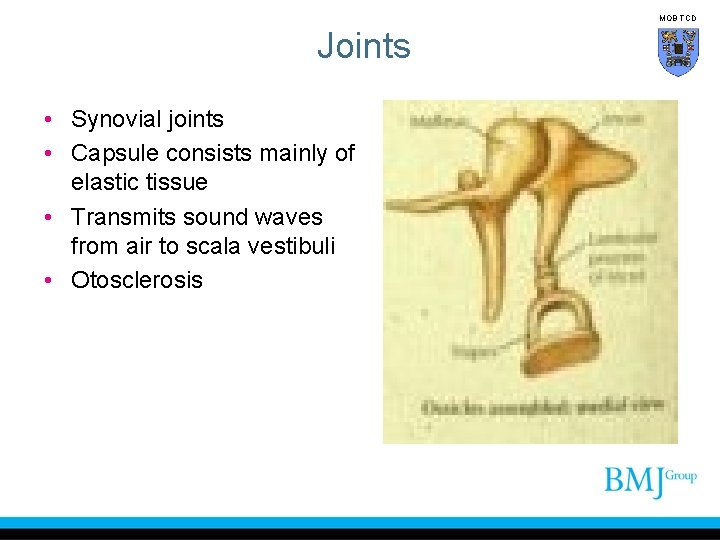 MOB TCD Joints • Synovial joints • Capsule consists mainly of elastic tissue •