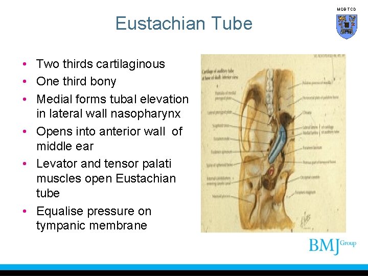 MOB TCD Eustachian Tube • Two thirds cartilaginous • One third bony • Medial