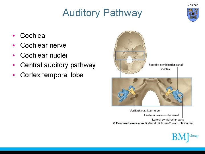 MOB TCD Auditory Pathway • • • Cochlear nerve Cochlear nuclei Central auditory pathway