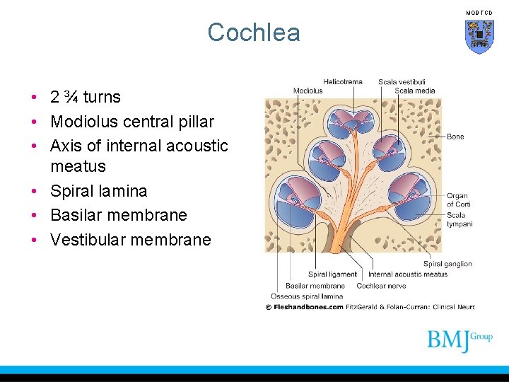 MOB TCD Cochlea • 2 ¾ turns • Modiolus central pillar • Axis of
