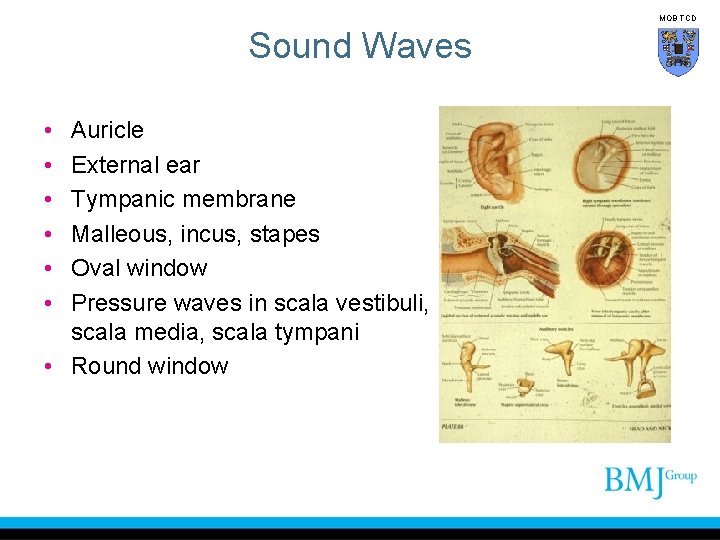 MOB TCD Sound Waves • • • Auricle External ear Tympanic membrane Malleous, incus,