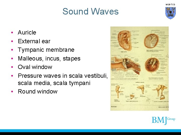 MOB TCD Sound Waves • • • Auricle External ear Tympanic membrane Malleous, incus,