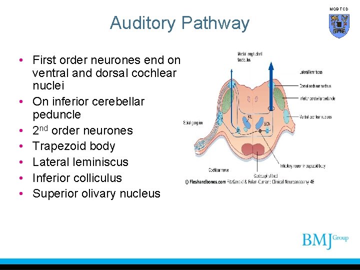 MOB TCD Auditory Pathway • First order neurones end on ventral and dorsal cochlear