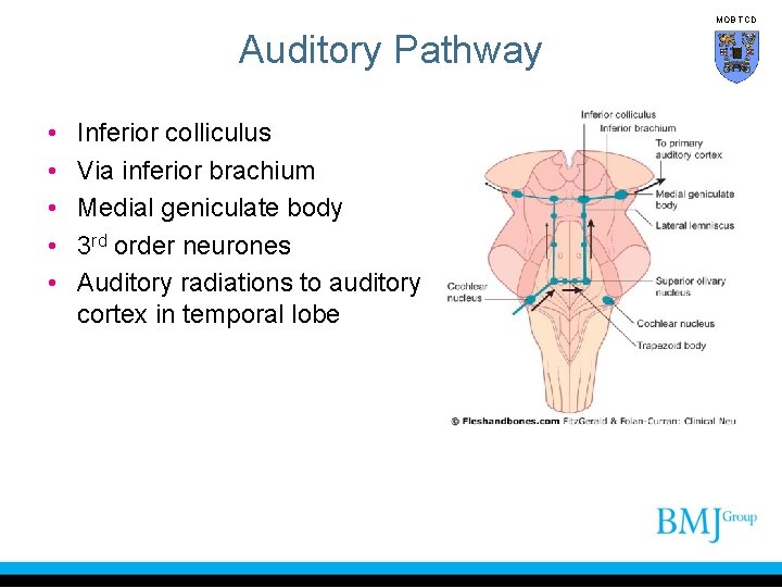 MOB TCD Auditory Pathway • • • Inferior colliculus Via inferior brachium Medial geniculate