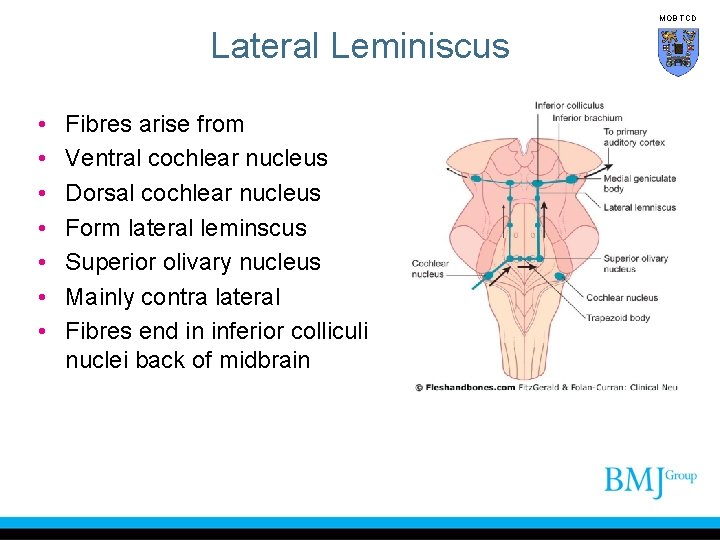 MOB TCD Lateral Leminiscus • • Fibres arise from Ventral cochlear nucleus Dorsal cochlear