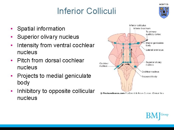 MOB TCD Inferior Colliculi • Spatial information • Superior olivary nucleus • Intensity from