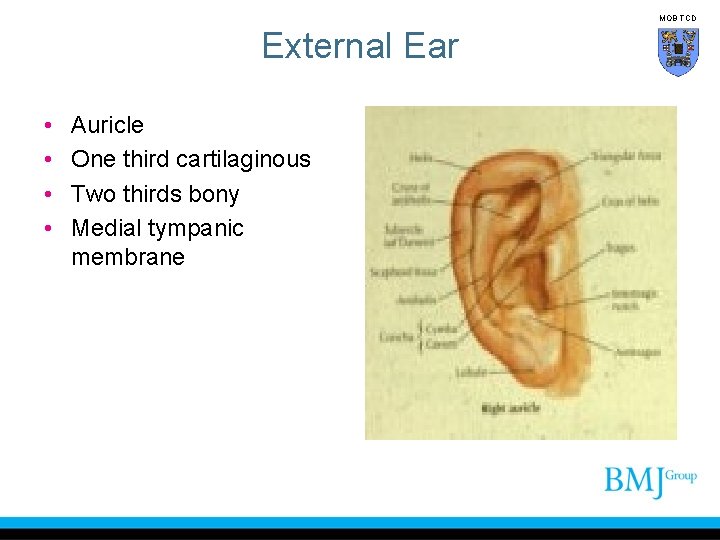 MOB TCD External Ear • • Auricle One third cartilaginous Two thirds bony Medial