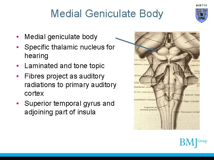 MOB TCD Medial Geniculate Body • Medial geniculate body • Specific thalamic nucleus for