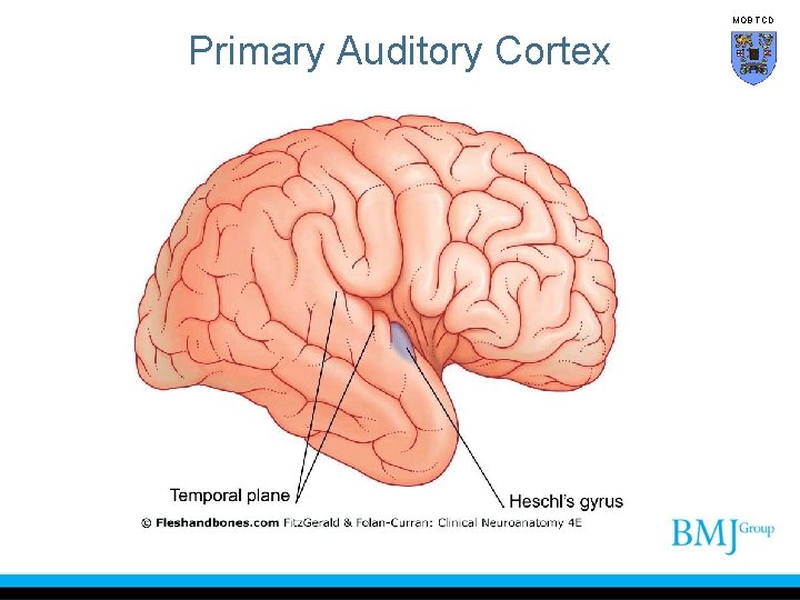 MOB TCD Primary Auditory Cortex 