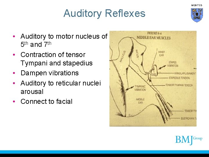 MOB TCD Auditory Reflexes • Auditory to motor nucleus of 5 th and 7