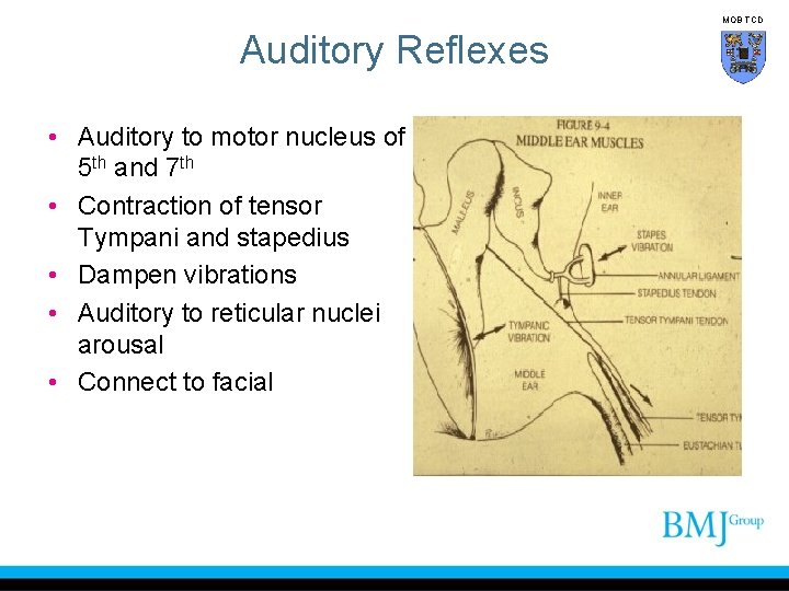 MOB TCD Auditory Reflexes • Auditory to motor nucleus of 5 th and 7