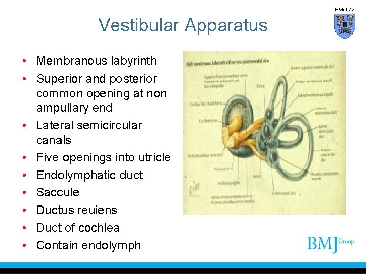 MOB TCD Vestibular Apparatus • Membranous labyrinth • Superior and posterior common opening at