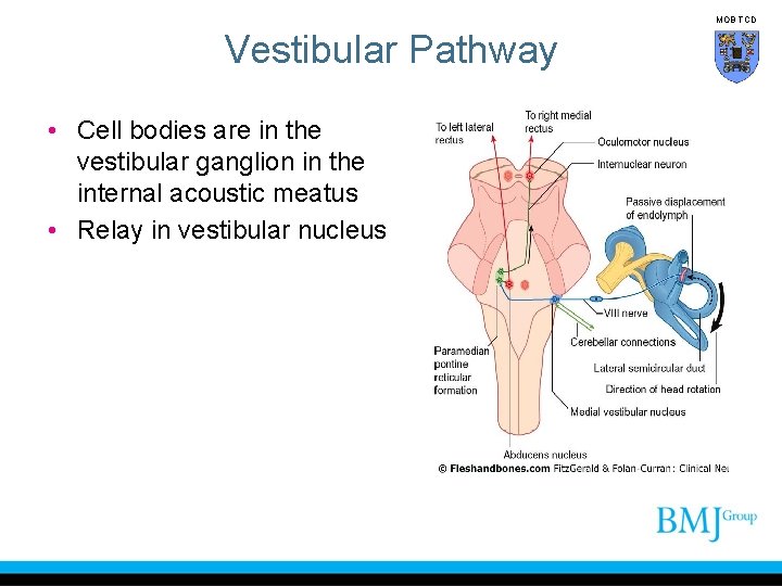 MOB TCD Vestibular Pathway • Cell bodies are in the vestibular ganglion in the