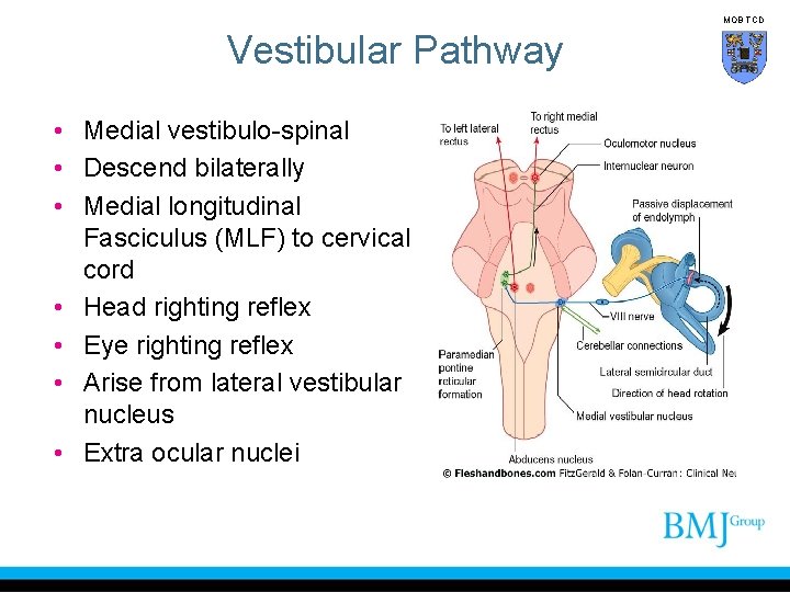 MOB TCD Vestibular Pathway • Medial vestibulo-spinal • Descend bilaterally • Medial longitudinal Fasciculus