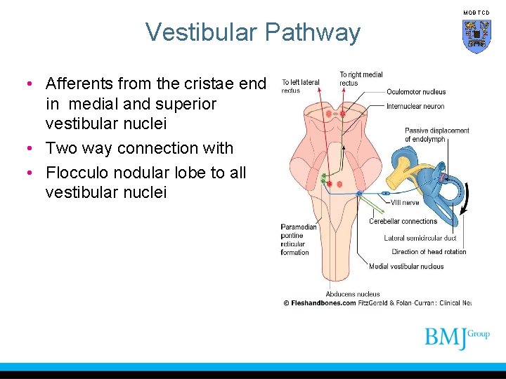 MOB TCD Vestibular Pathway • Afferents from the cristae end in medial and superior