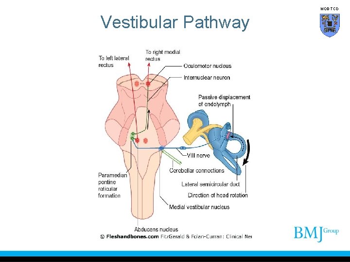 MOB TCD Vestibular Pathway 