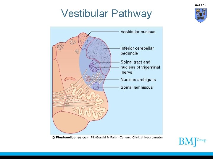 MOB TCD Vestibular Pathway 