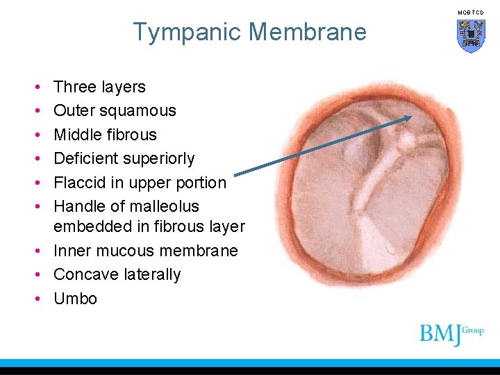 MOB TCD Tympanic Membrane • • • Three layers Outer squamous Middle fibrous Deficient