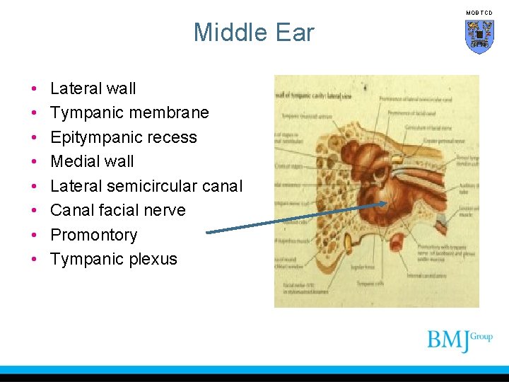 MOB TCD Middle Ear • • Lateral wall Tympanic membrane Epitympanic recess Medial wall