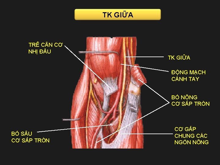 TK GIỮA TRẼ C N CƠ NHỊ ĐẦU TK GIỮA ĐỘNG MẠCH CÁNH TAY