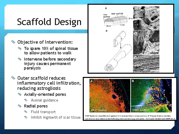 Scaffold Design Objective of Intervention: To spare 10% of spinal tissue to allow patients Scaffold Design Objective of Intervention: To spare 10% of spinal tissue to allow patients