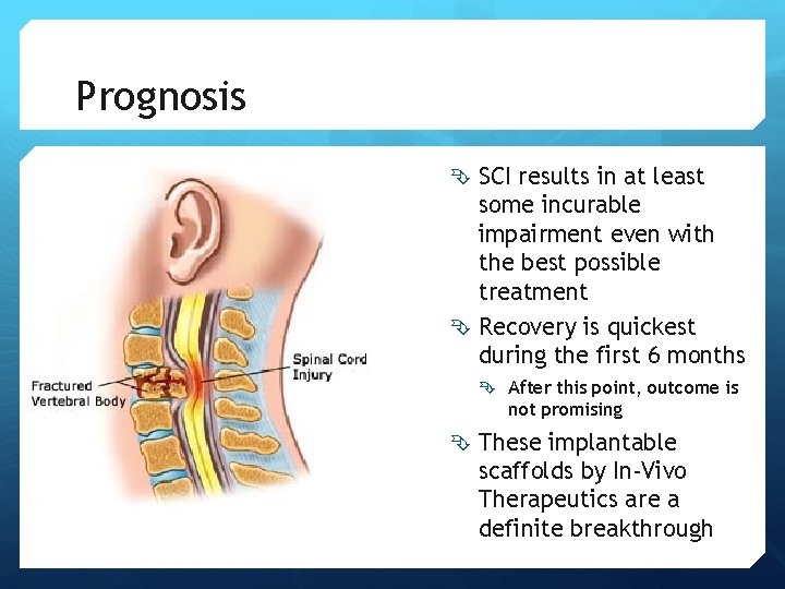 Prognosis SCI results in at least some incurable impairment even with the best possible Prognosis SCI results in at least some incurable impairment even with the best possible