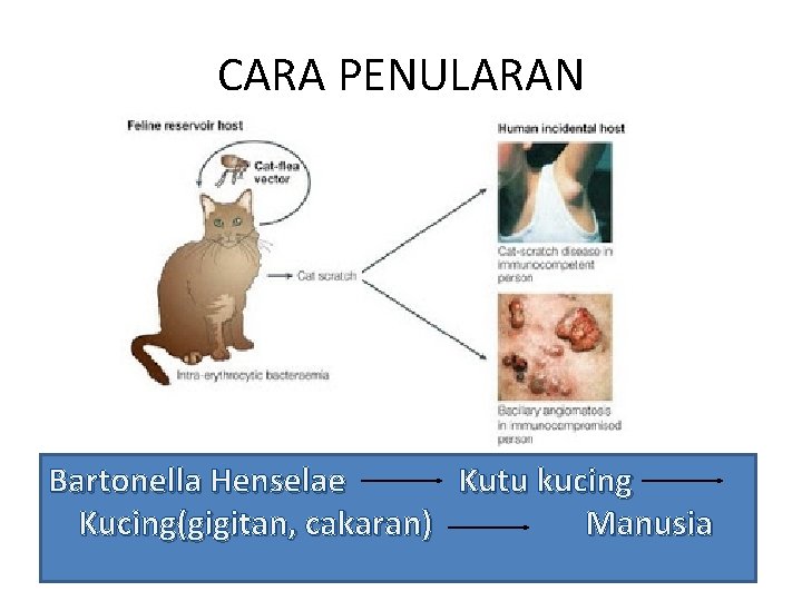 CARA PENULARAN Bartonella Henselae Kutu kucing Kucing(gigitan, cakaran) Manusia 
