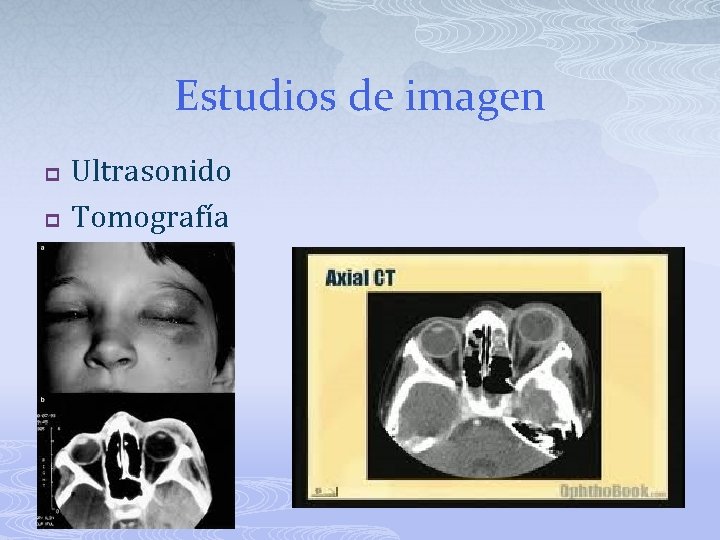 Estudios de imagen p p Ultrasonido Tomografía 