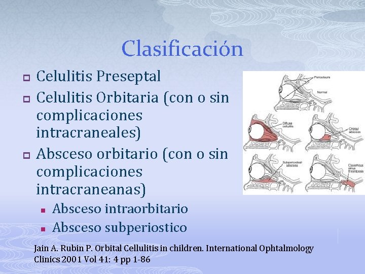Clasificación p p p Celulitis Preseptal Celulitis Orbitaria (con o sin complicaciones intracraneales) Absceso