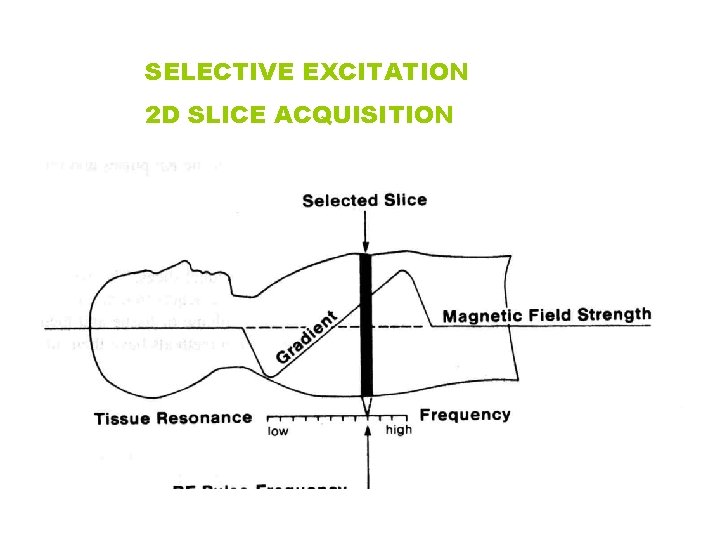 SELECTIVE EXCITATION 2 D SLICE ACQUISITION 