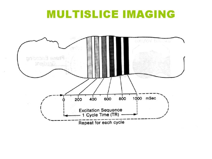 MULTISLICE IMAGING 