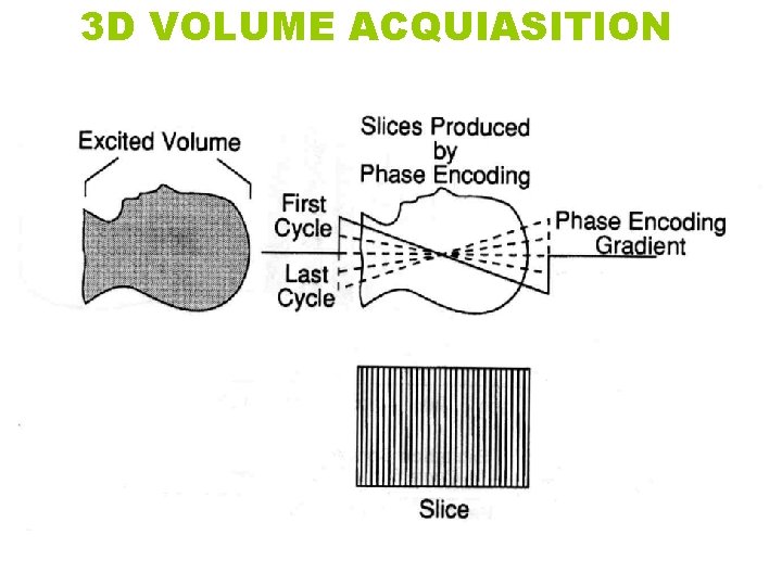 3 D VOLUME ACQUIASITION 