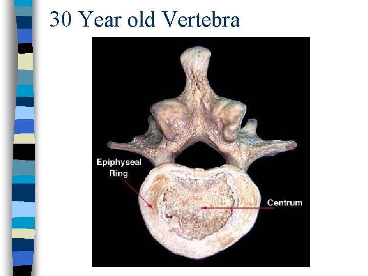 30 Year old Vertebra 