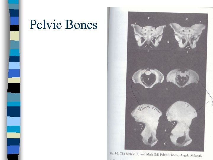 Pelvic Bones 