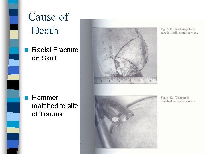 Cause of Death n Radial Fracture on Skull n Hammer matched to site of