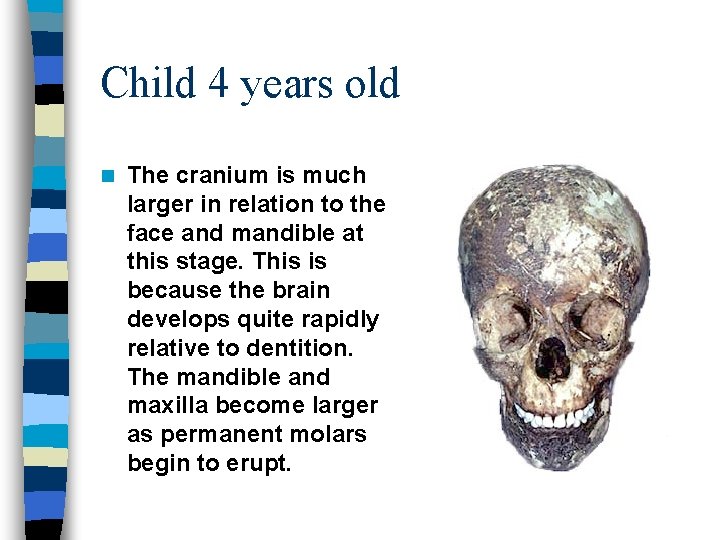 Child 4 years old n The cranium is much larger in relation to the