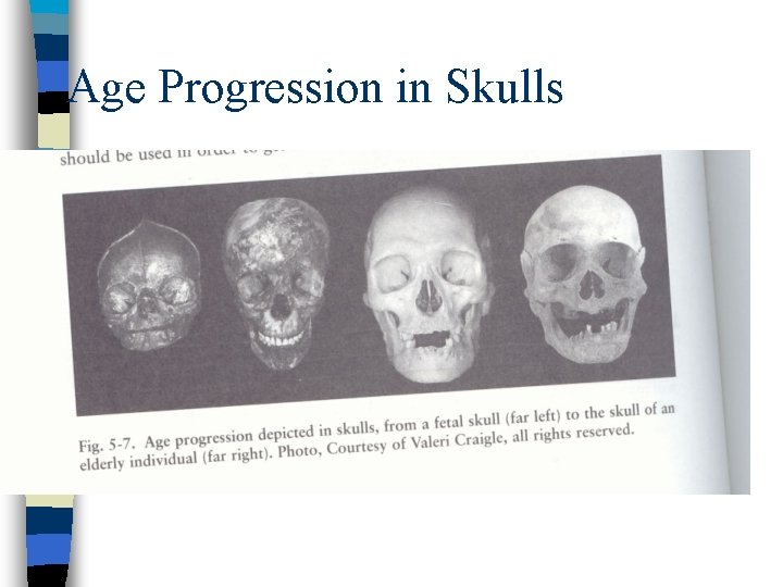 Age Progression in Skulls 