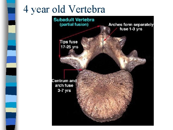 4 year old Vertebra 
