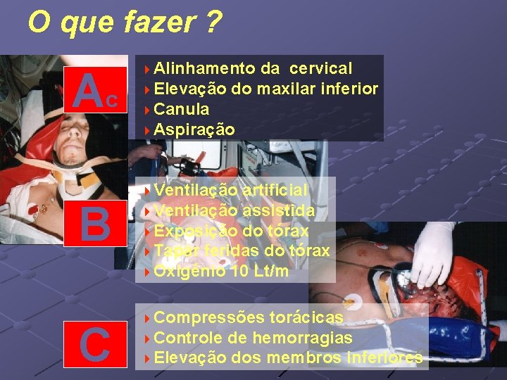 O que fazer ? Ac B C 4 Alinhamento da cervical 4 Elevação do O que fazer ? Ac B C 4 Alinhamento da cervical 4 Elevação do
